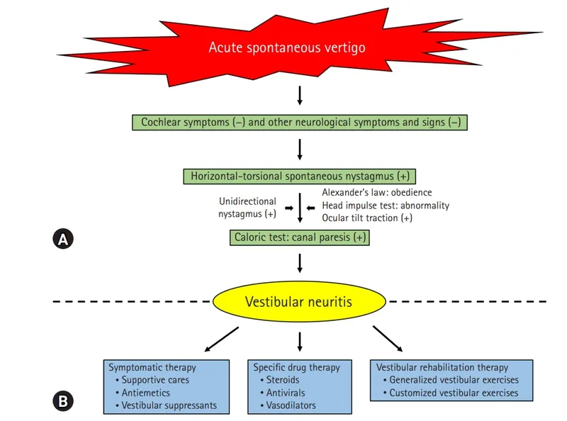 Vestibular Neuritis Diagnosis and Management