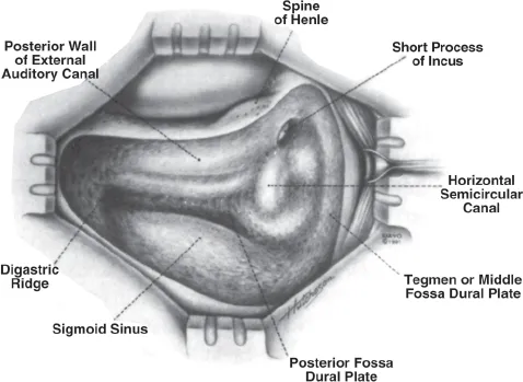 Surgical anatomy of mastoid bone