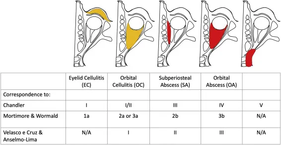 Chandler Classification of Orbital Complications