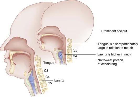 Pediatric vs Adult Larynx Anatomy