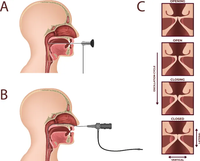 Laryngeal endoscopy and vocal fold oscillation