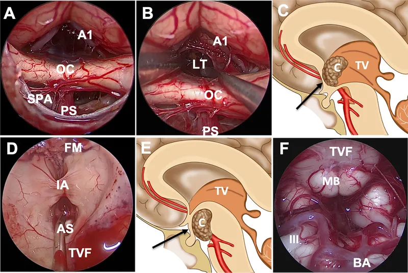 Endoscopic view of key anatomical landmarks