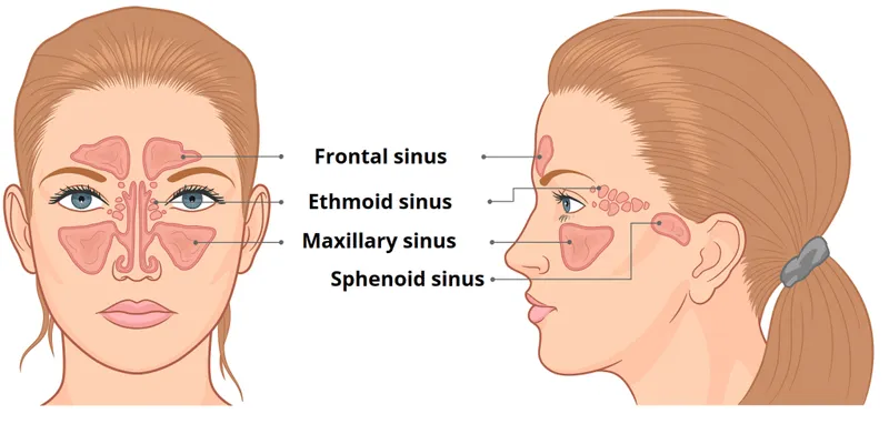 Paranasal Sinuses Anatomy