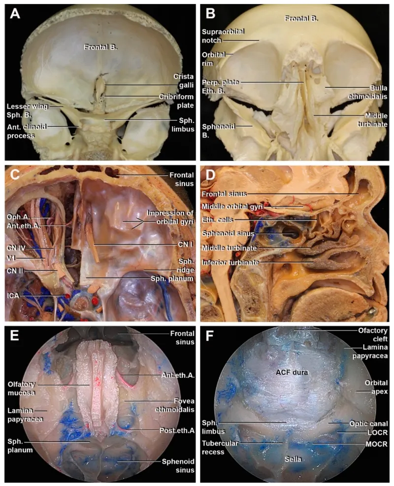 Skull base anatomy and cranial nerves