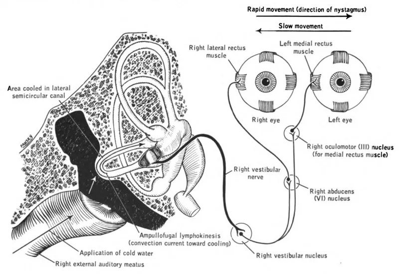 Caloric Test Mechanism Diagram
