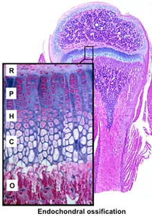 Epiphyseal growth plate zones micrograph