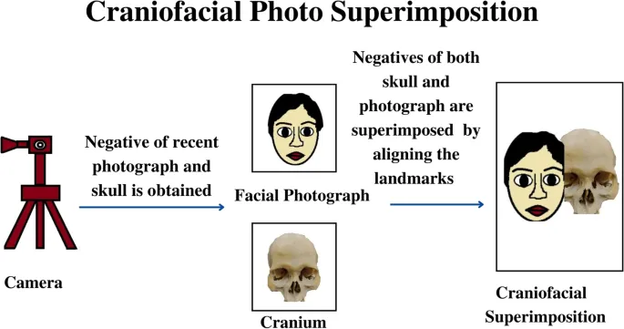 Craniofacial Photo Superimposition Diagram