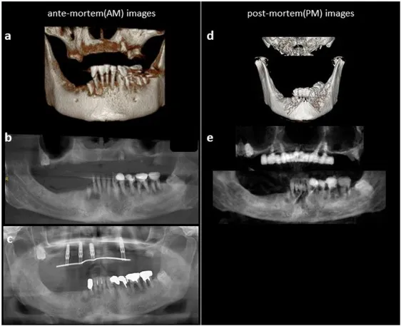 AM/PM dental images for forensic ID