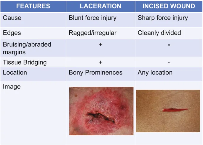 Laceration vs Incised Wound Features