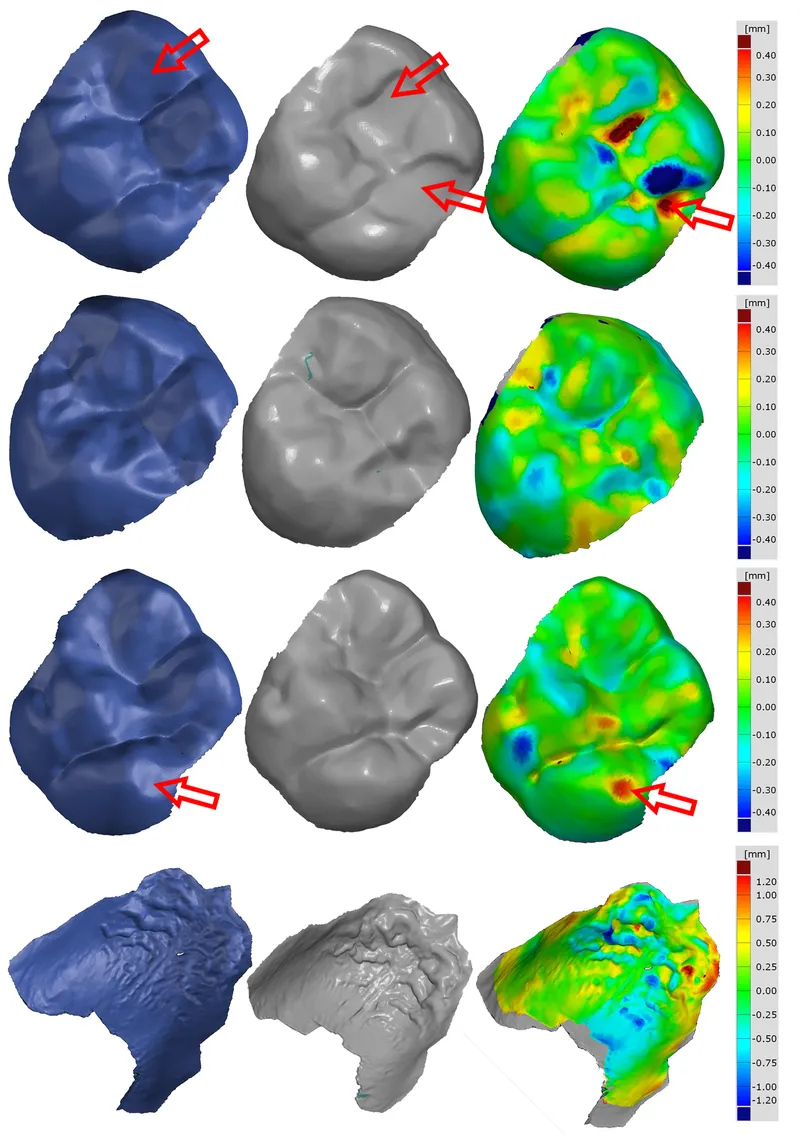 3D dental comparison for victim identification