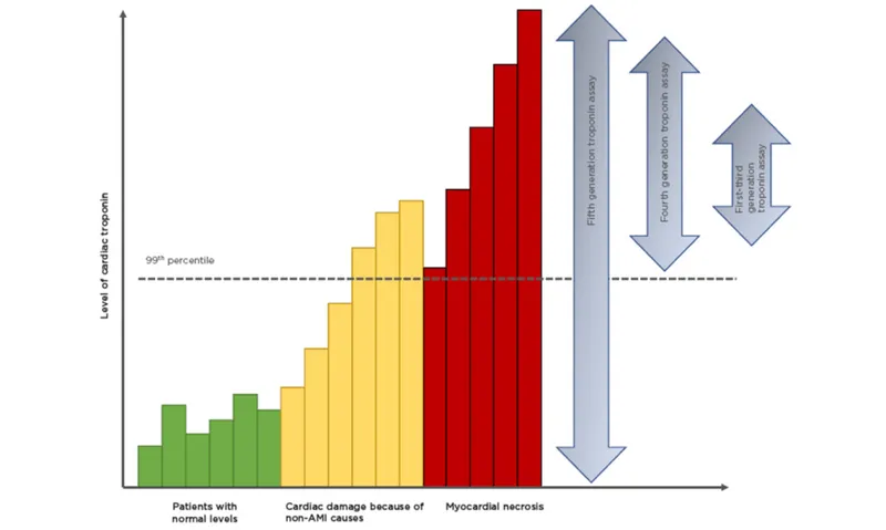 Cardiac Troponin Levels and Assay Generations