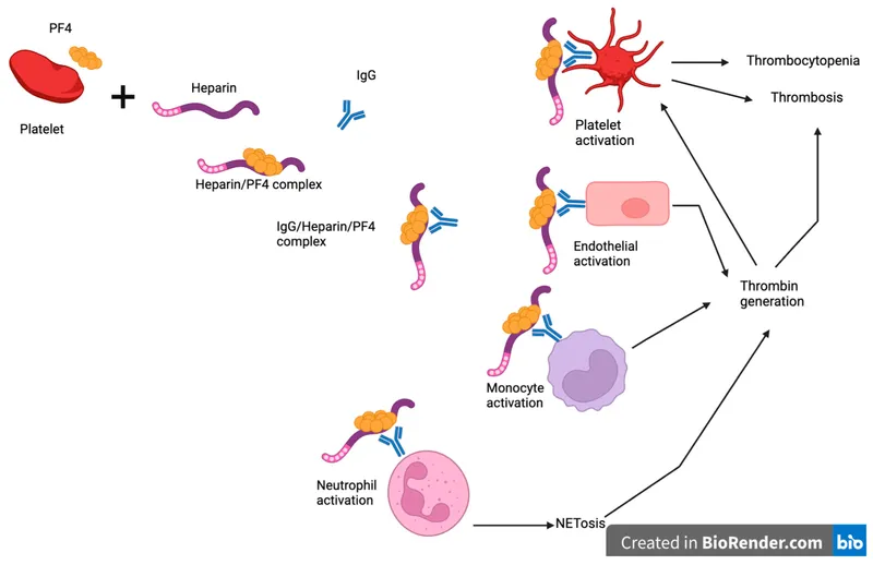 Heparin-Induced Thrombocytopenia Pathophysiology