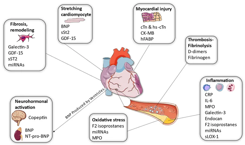 Biomarkers in Acute Coronary Syndrome
