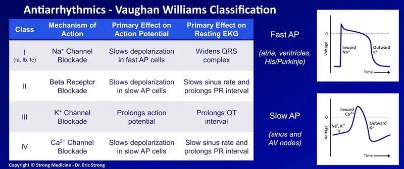 Vaughan Williams Classification of Antiarrhythmics