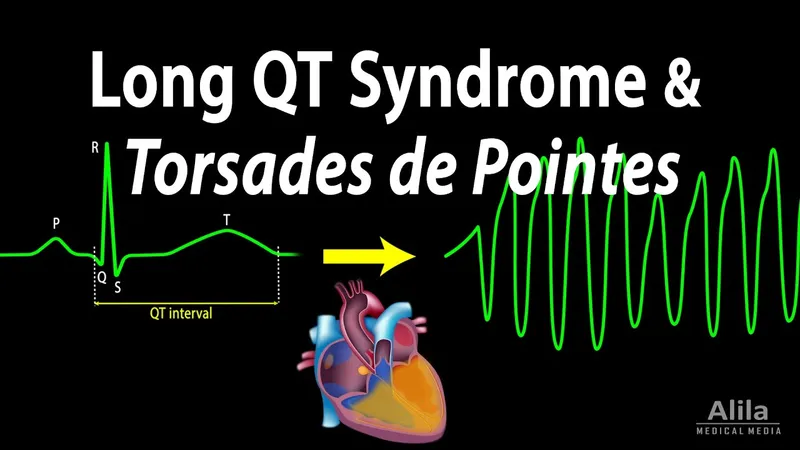 Long QT Syndrome and Torsades de Pointes ECG