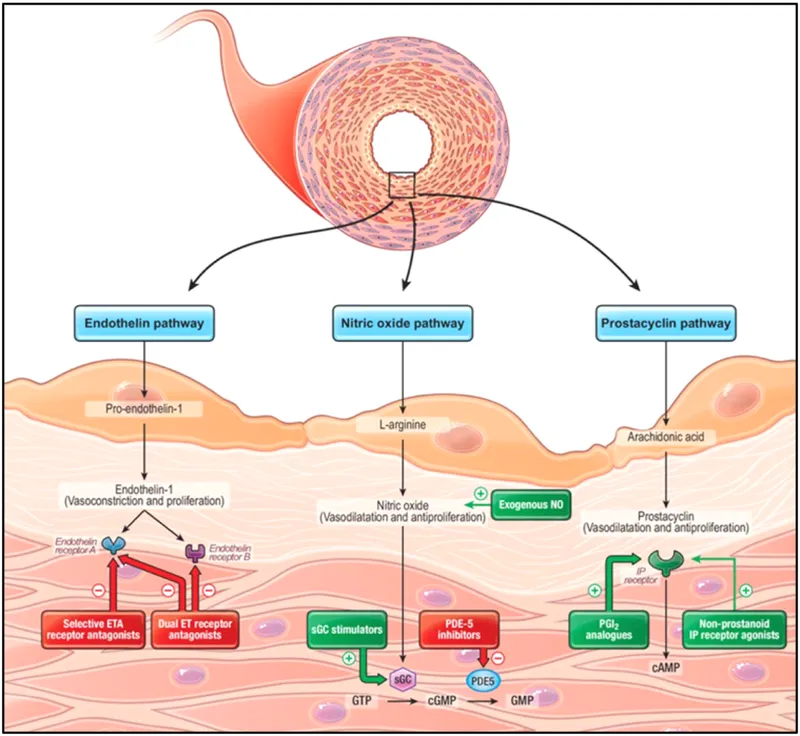 Pulmonary Hypertension Targeted Therapy Pathways