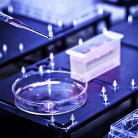 High-throughput screening in drug discovery