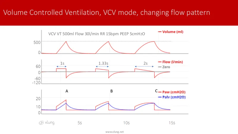 VCV mode waveforms with changing flow patterns