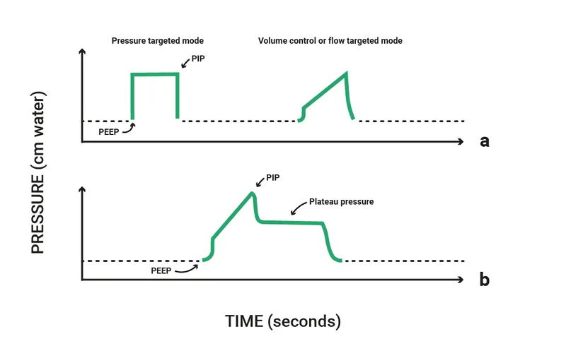 Ventilator pressure waveforms