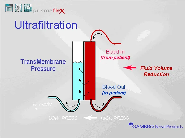 RRT Principles: Diffusion, Convection, Ultrafiltration