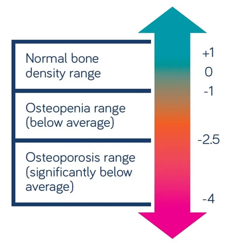 DEXA Scan T-Score Interpretation