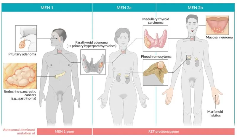 MEN 1, 2a, and 2b features