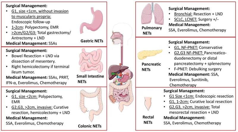 NET treatment by location and grade