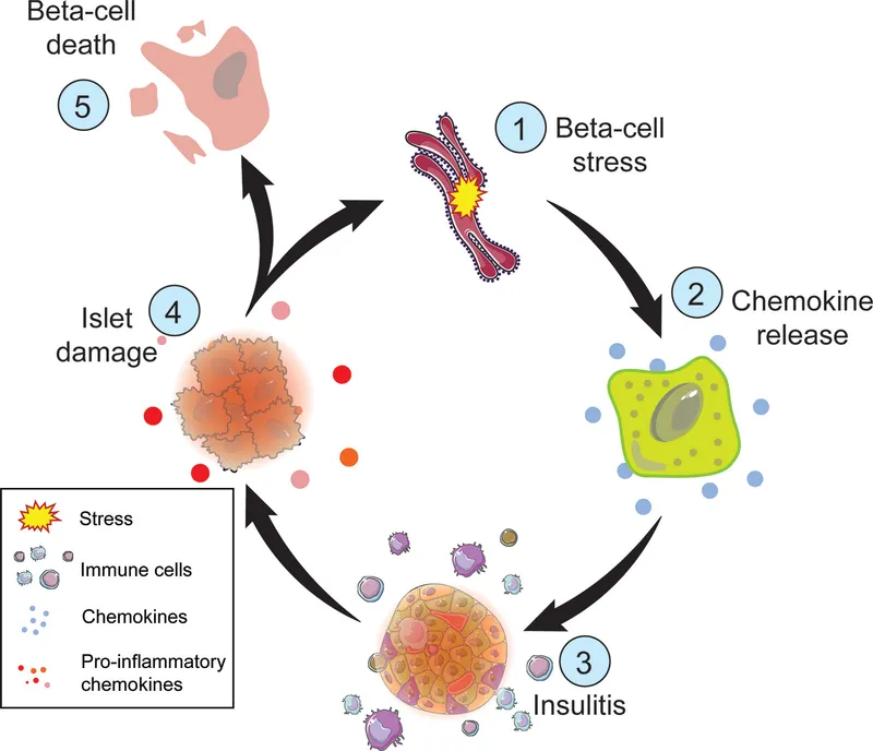 Pathogenesis of Type 1 Diabetes Mellitus