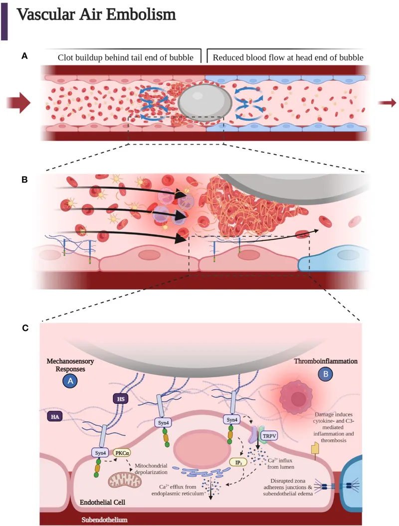 Vascular Air Embolism and Thromboinflammation