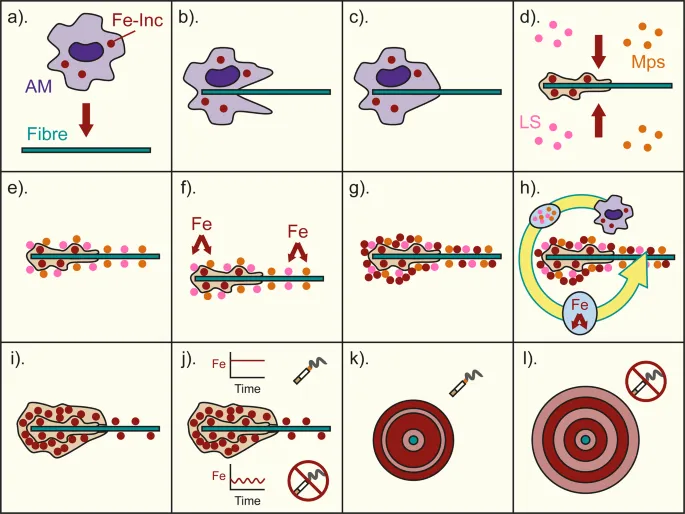 Formation of ferruginous bodies in asbestosis