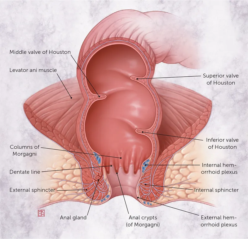 Anorectal Anatomy with Hemorrhoid Plexus and Dentate Line