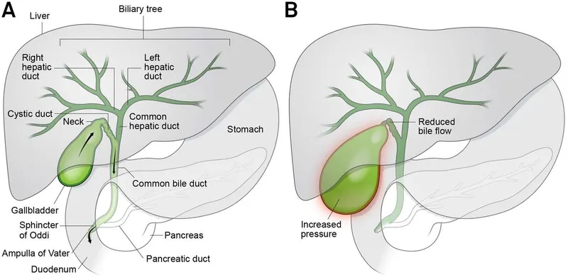 Biliary Tract Anatomy and Obstruction