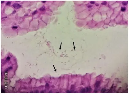 H. pylori in gastric pit, histopathology