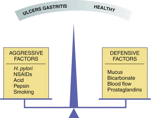 Gastric Mucosal Balance: Aggressive vs. Defensive Factors