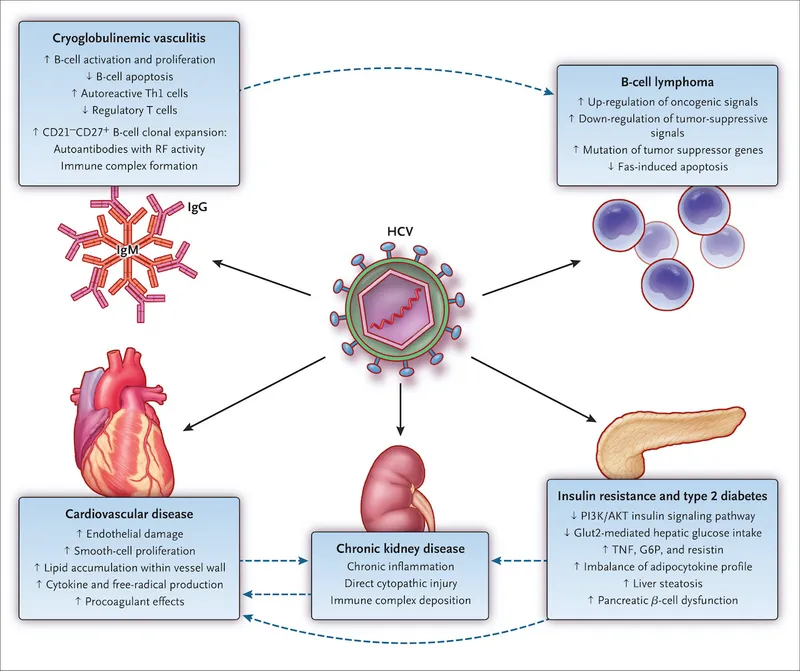 HCV extrahepatic manifestations diagram
