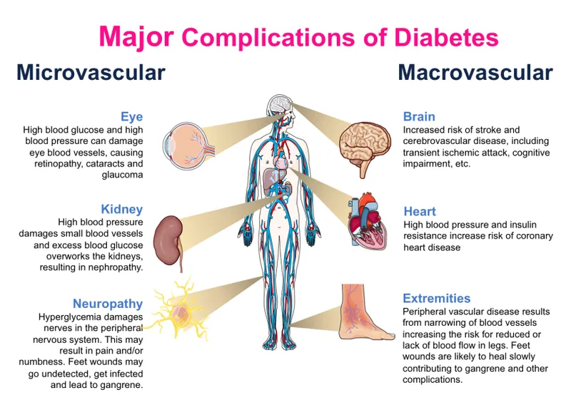 Diabetic Complications: Microvascular & Macrovascular
