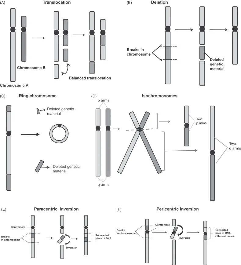 Types of chromosomal structural abnormalities