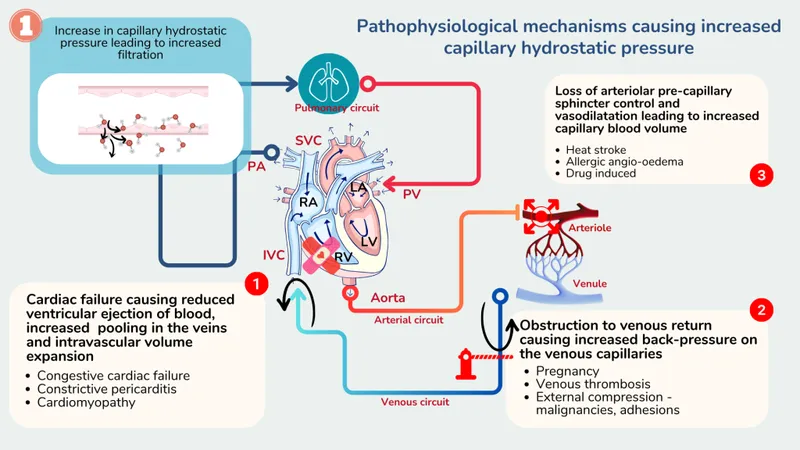 Pathophysiology of increased capillary hydrostatic pressure