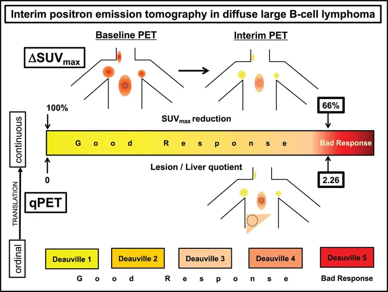 Interim PET in DLBCL: SUVmax reduction and Deauville score