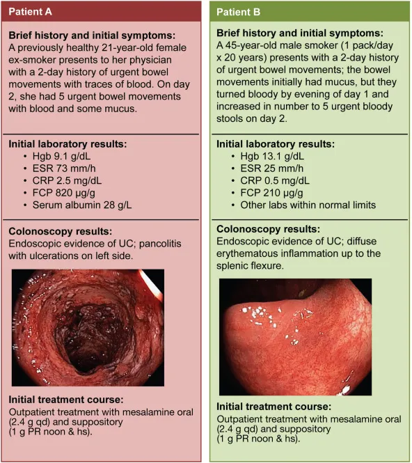 UC patient cases: Pancolitis vs. Left-sided Colitis