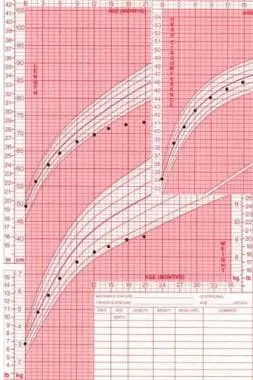 Pediatric growth chart showing growth failure in Crohn's