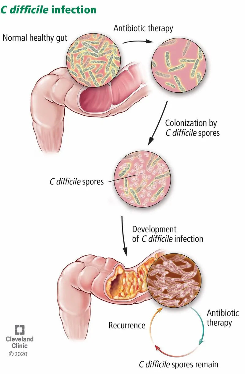 C. difficile infection cycle