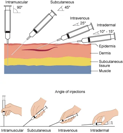 Injection angles and tissue layers