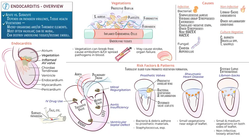 Endocarditis Overview: Vegetations, Causes, Risk Factors