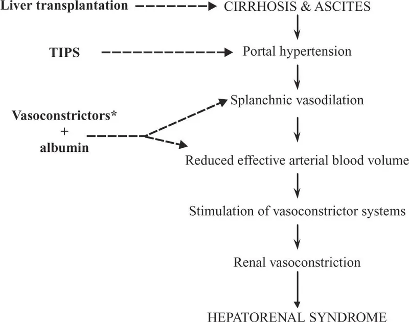Hepatorenal Syndrome Pathophysiology and Treatment