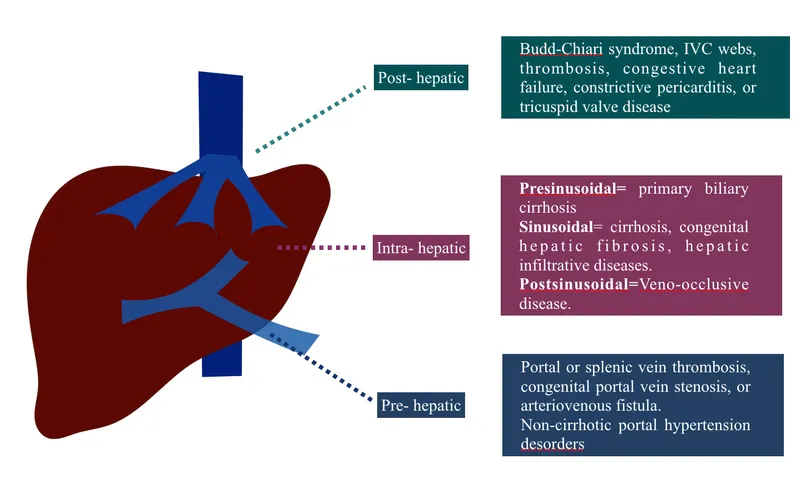 Causes of Portal Hypertension: Pre-, Intra-, Post-hepatic