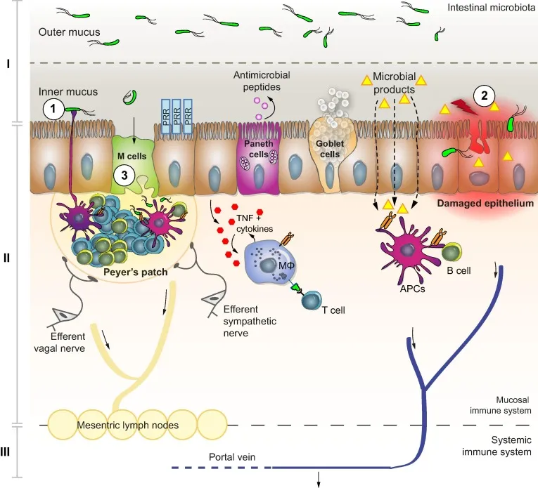 Bacterial Translocation in Cirrhosis Pathophysiology
