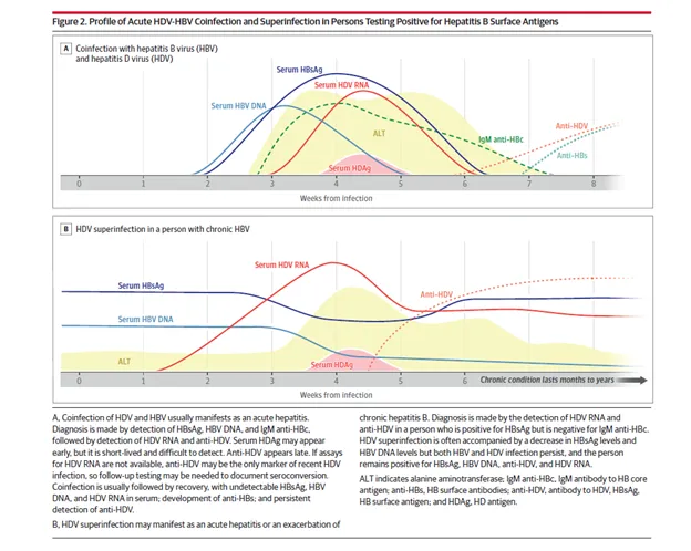 HDV-HBV Coinfection vs. Superinfection Profiles