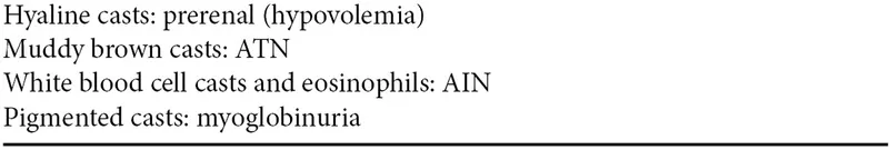 Urinary casts and associated kidney conditions