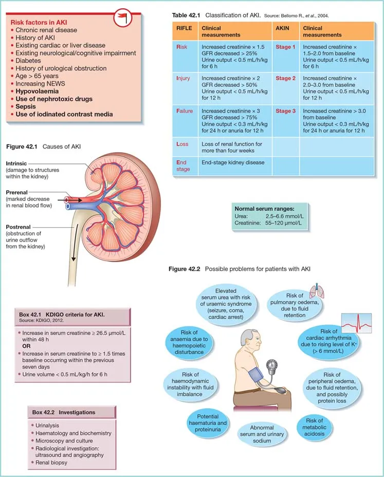 Acute Kidney Injury: Causes, Classification, & Complications